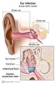 ears figure
